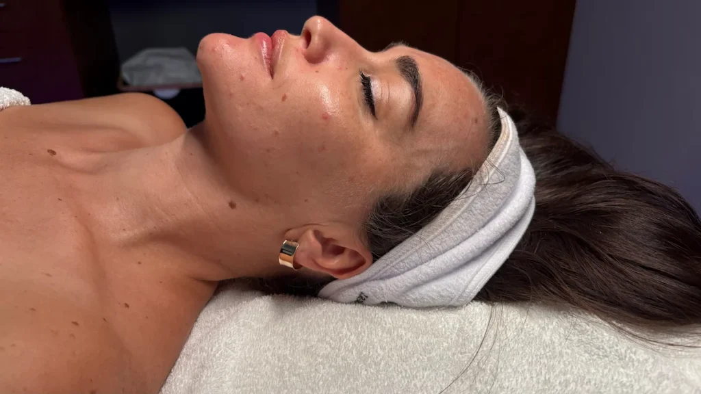 Hydrafacial treatment close up showing freshly cleansed skin at Parie Med Spa