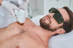 Chest laser hair removal at Parie Med Spa treatment session