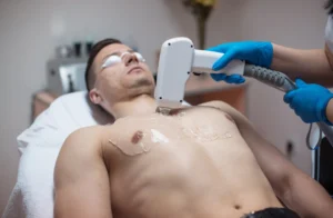 Chest and stomach laser hair removal at Parie Med Spa treatment session
