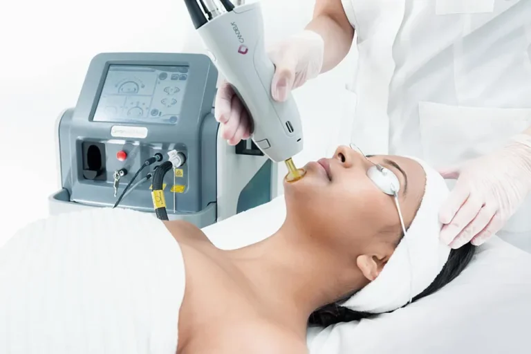 Candela laser handpiece used on a model's face during a laser treatment, manufacturer image