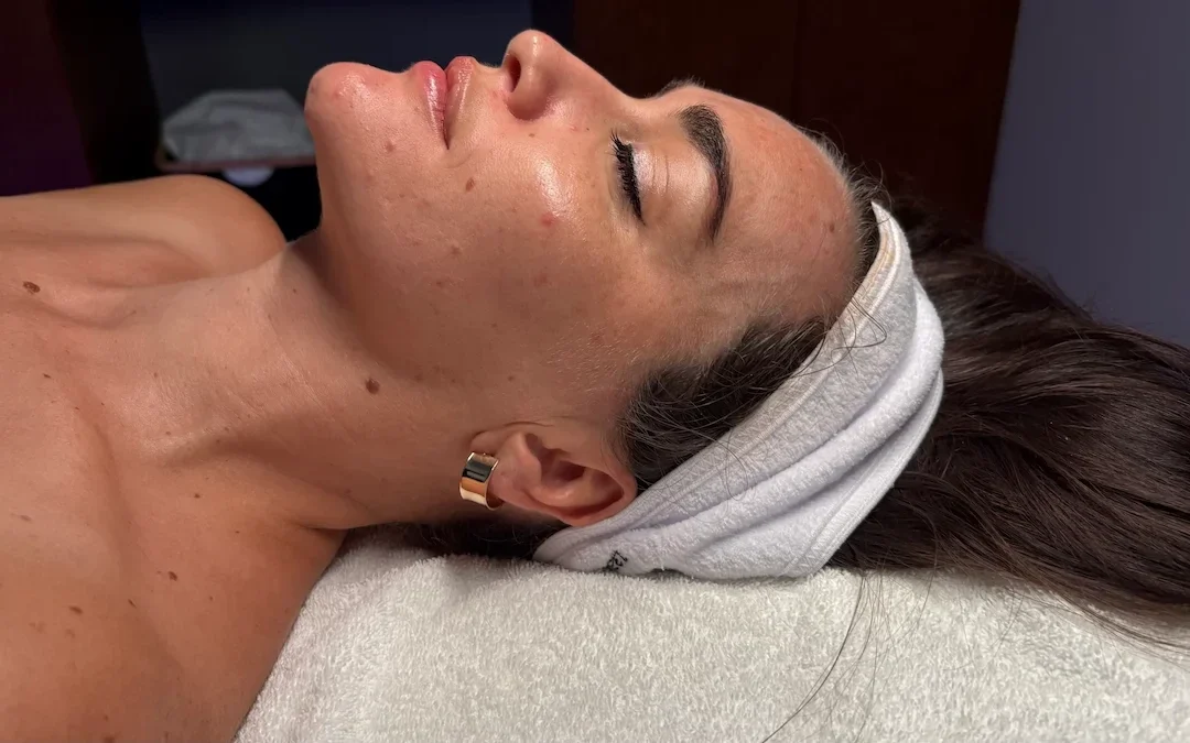 Salmon DNA Facial in Las Vegas: What Happens During Your Treatment