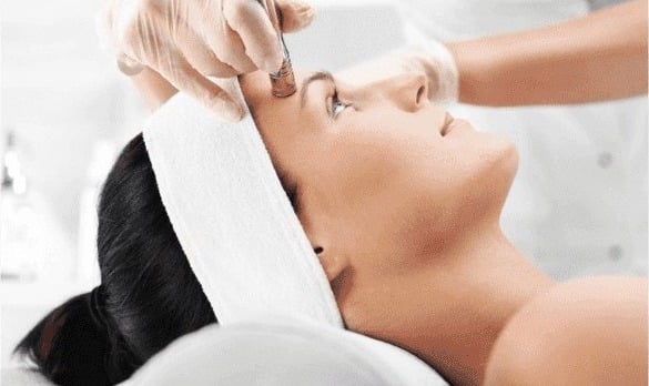 Morpheus8 Recovery Day by Day: What to Expect After Your Session